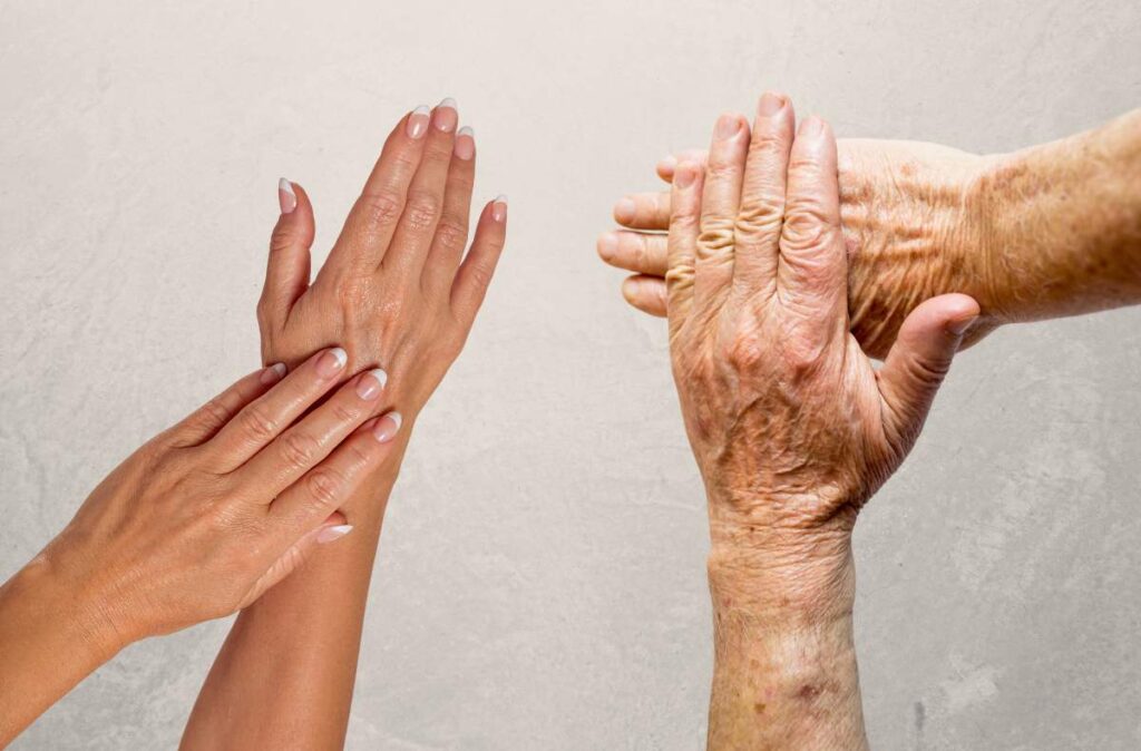 Mãos ressecadas e envelhecidas? Confira essas dicas! - Comparação entre mãos jovens e idosas